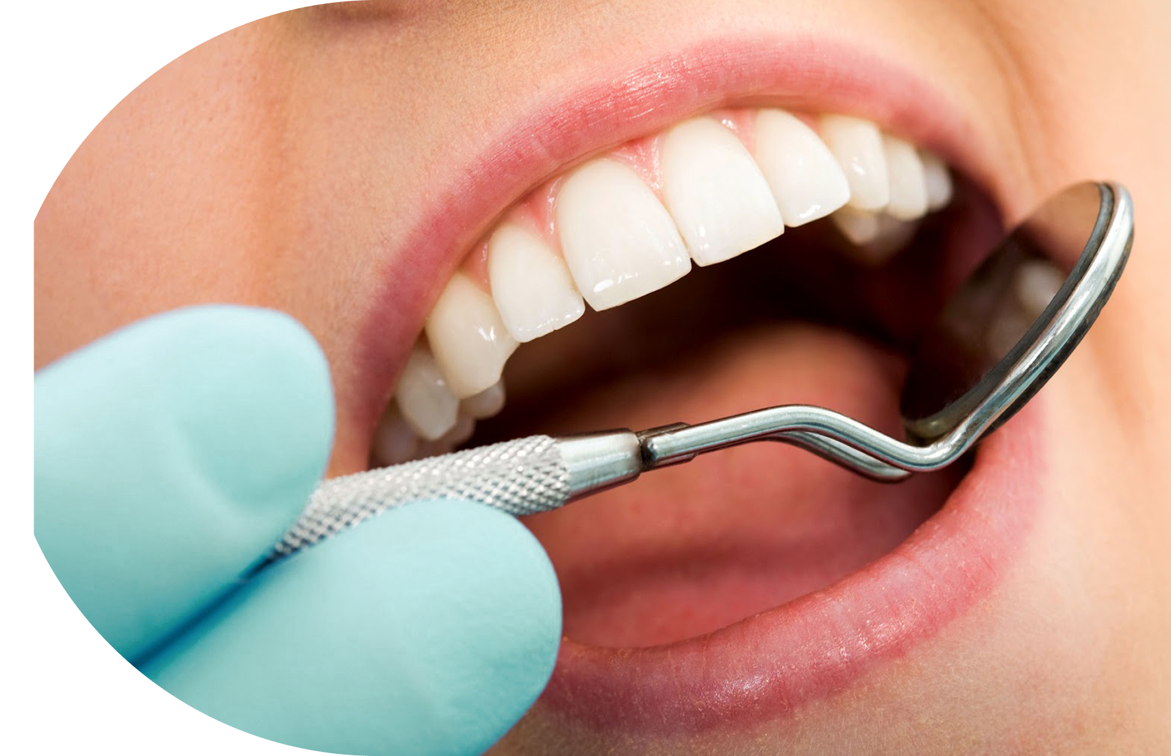 limpieza-dental
