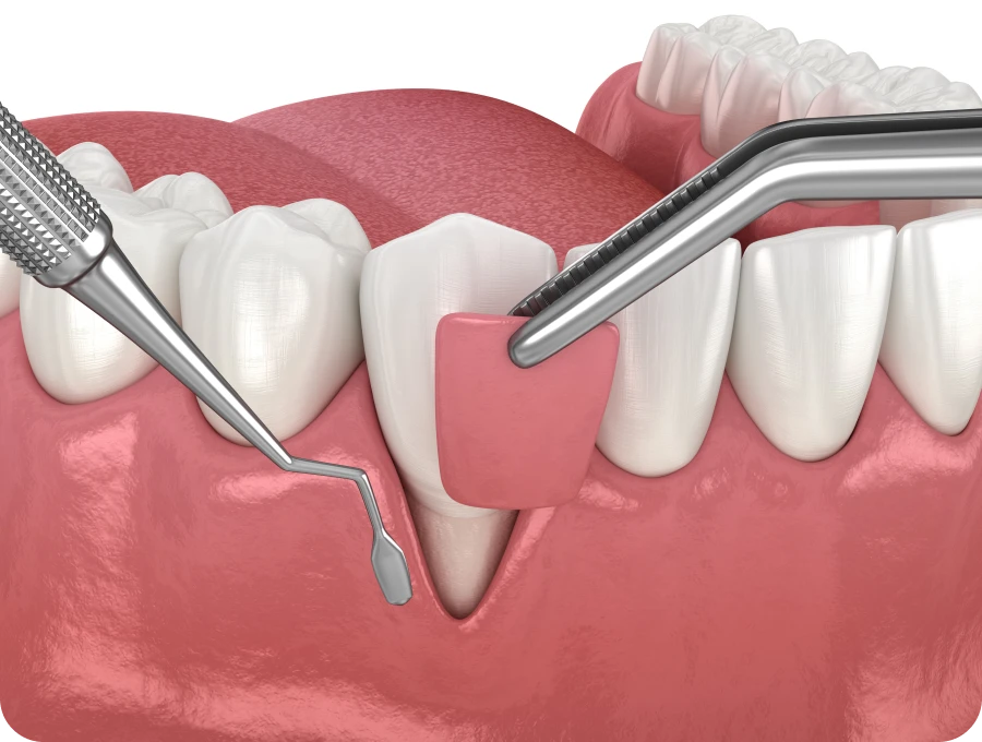 Dentiste Valenciennes 59300