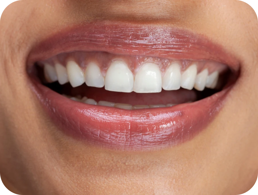 frenectomie dentiste sierocki