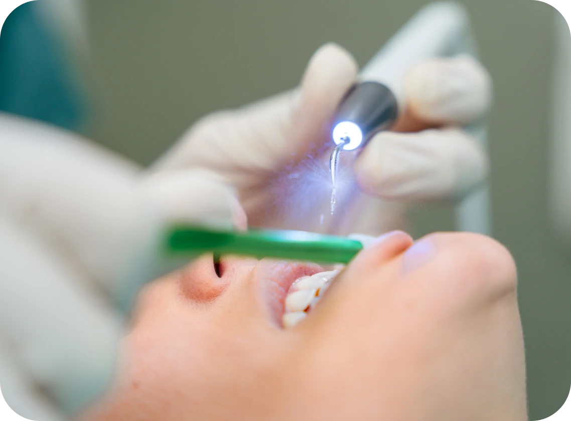 Dentiste Valenciennes 59300 : laser diode